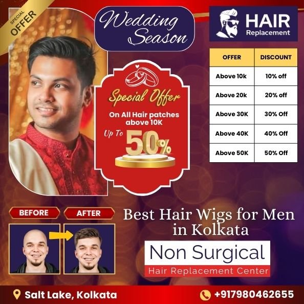 Restore your hairstyle with non-surgical hair replacement in Kolkata, starting at just ₹5999! Hair Wig Fixing Center is the top-rated hair replacement clinic in Kolkata, helping men overcome baldness and achieve their dream look. This wedding season, enjoy *Flat 50% Off* on hair wigs and patches priced above ₹50,000. Visit us at College Street, Kolkata!